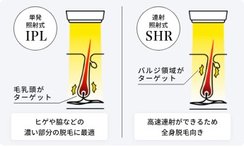 ヒゲも うぶ毛も OK IPL・SHR 両対応